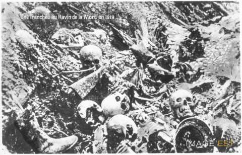 Ossements humains (Verdun)